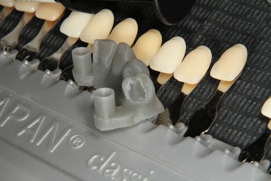 Modelo impreso en 3D de un caso sobre implantes, junto a la guía de color VITA
